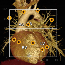 Berardinelli Seip congenital lipodystrophy