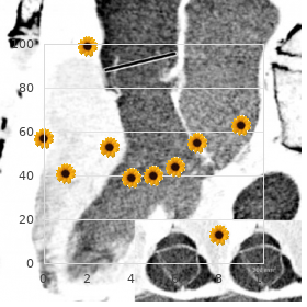 Lichstenstein syndrome