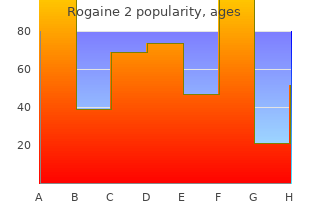 60 ml rogaine 2 mastercard