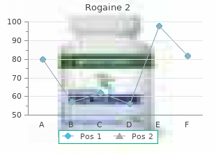 discount rogaine 2 60 ml with visa